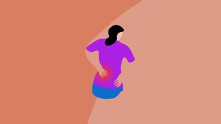 Eine Frau hält sich den schmerzenden Rücken (Illustration).