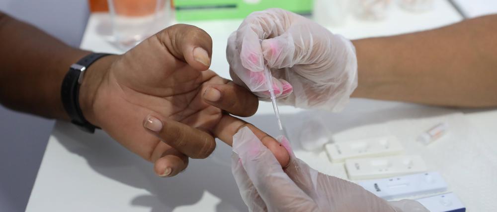 Der Zugang zu HIV-Prävention wird in vielen Ländern abrupt beendet. Auch Deutschland streicht Fördermittel.