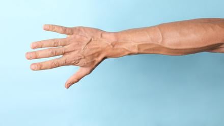 Starke Venen an einem Männerarm