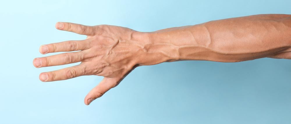 Starke Venen an einem Männerarm