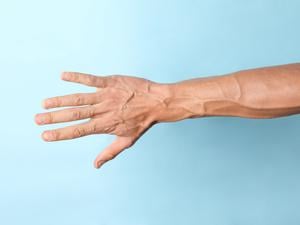 Starke Venen an einem Männerarm