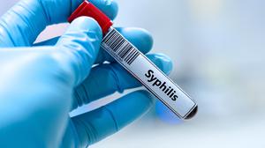 Eine Probe mit der Aufschrift „Syphilis“.