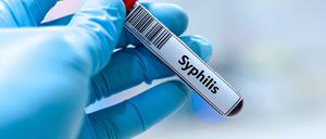 Eine Probe mit der Aufschrift „Syphilis“.
