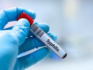 Eine Probe mit der Aufschrift „Syphilis“.