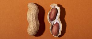 Seit 2021 geht in den USA der Rat an Eltern sogar dahin, Kinder im Alter von vier bis sechs Monaten mit allen wichtigen Lebensmittel-Allergenen vertraut zu machen.