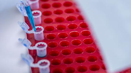 Die Berlin Science Week läuft bis zum 10. November. (Symbolbild)