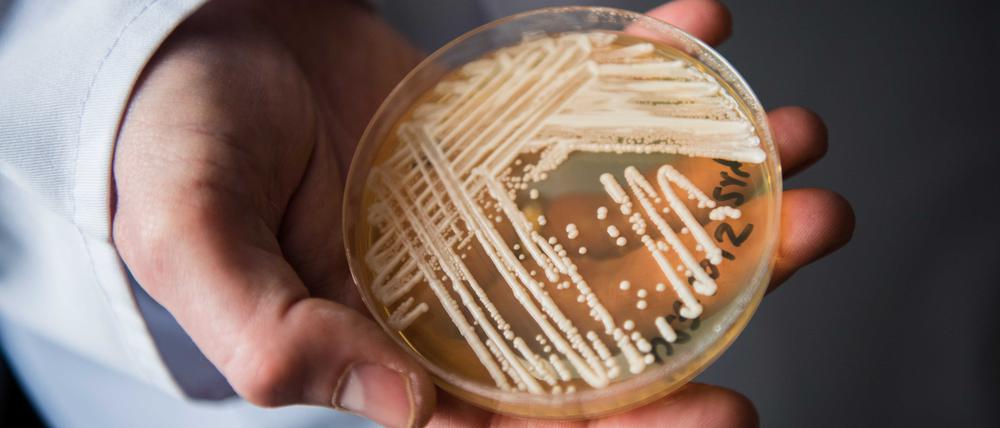 Candida auris in einer Kulturschale.