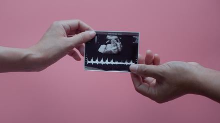 Zwei Hände halten ein Ultraschallbild, auf dem ein Baby zu erkennen ist.