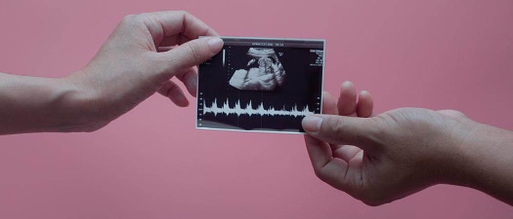 Zwei Hände halten ein Ultraschallbild, auf dem ein Baby zu erkennen ist.