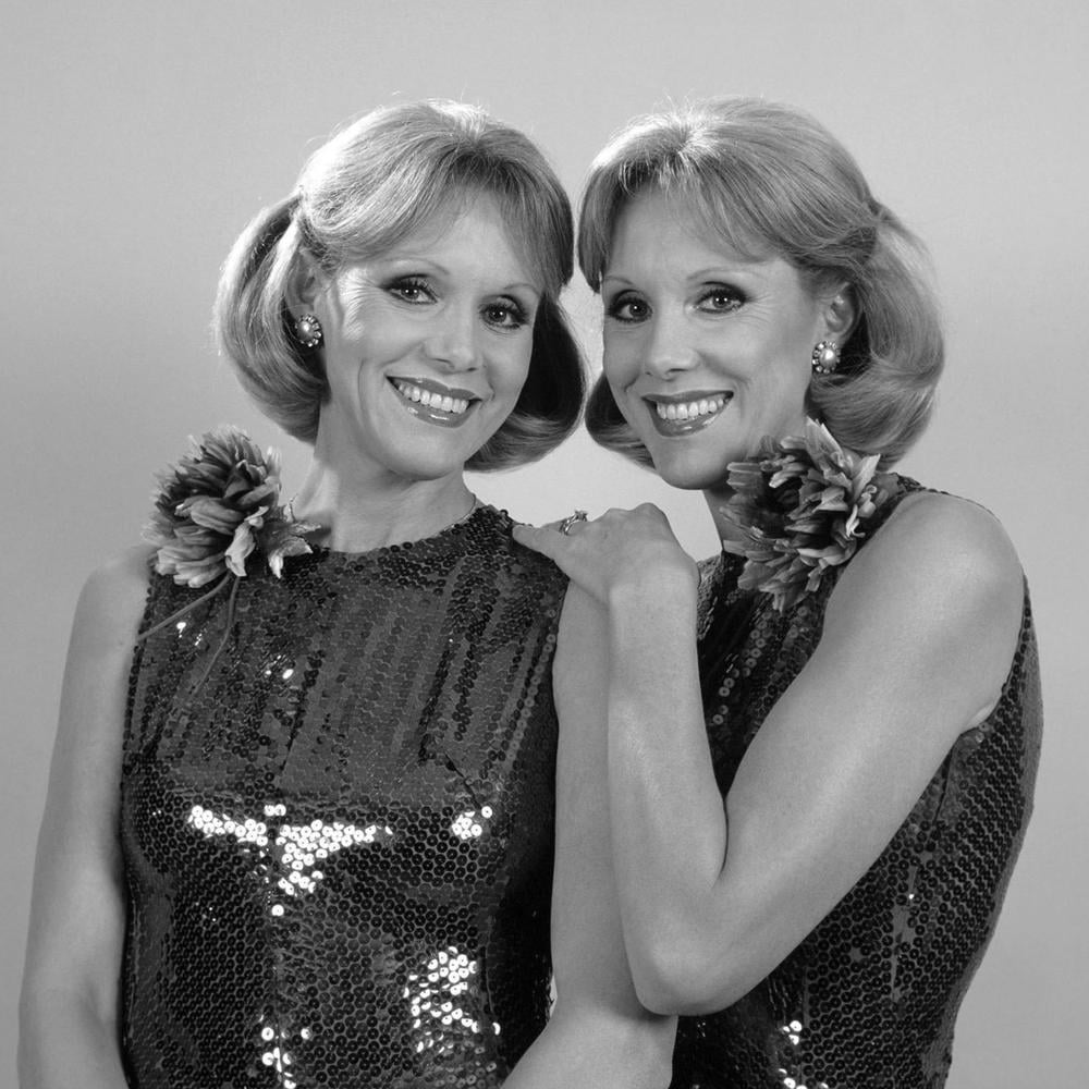 Nachruf auf die Kessler-Zwillinge: Unzertrennlich im Leben und im Tod