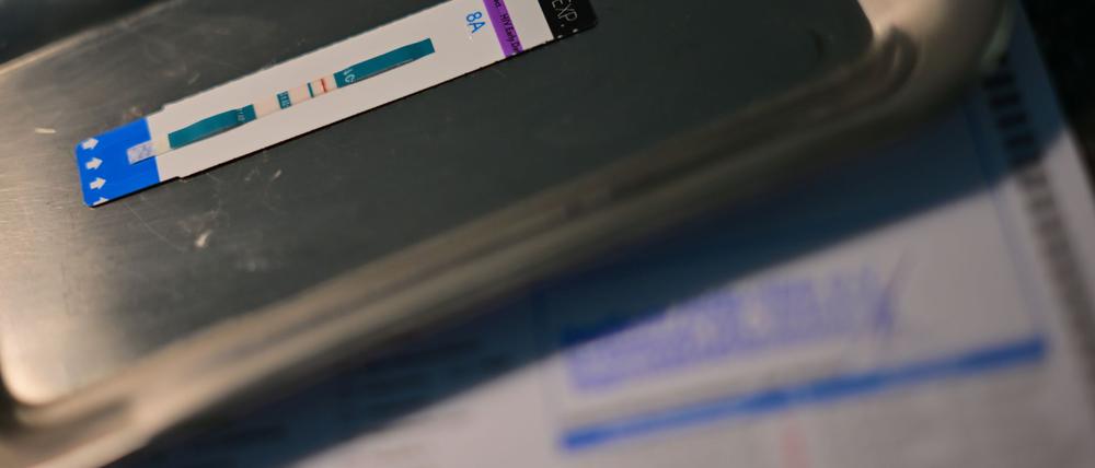 HIV-Diagnosen werden oft erst Jahre nach der Infektion gestellt. (Symbolbild)