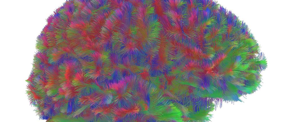 Sogenannte MRT-Diffusionsscans lassen deutliche Unterschiede der Hirnstruktur abhängig vom Alter erkennen.