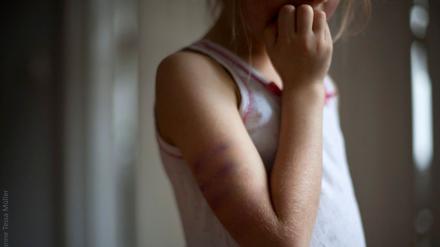 Eine medizinische Kinderambulanz startet im April 2026 in Potsdam. Kindesmisshandlung ist einer der Bereiche, um die es dabei geht.