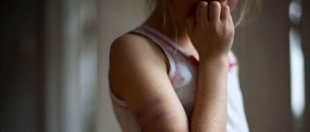 Eine medizinische Kinderambulanz startet im April 2026 in Potsdam. Kindesmisshandlung ist einer der Bereiche, um die es dabei geht.