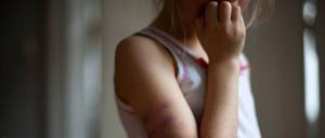 Eine medizinische Kinderambulanz startet im April 2026 in Potsdam. Kindesmisshandlung ist einer der Bereiche, um die es dabei geht.