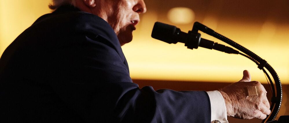 US-Präsident Donald Trump trägt ein Pflaster an seiner rechten Hand, als er am 9. Dezember 2025 im Mount Airy Casino Resort in Mount Pocono, Pennsylvania, eine Rede hält.