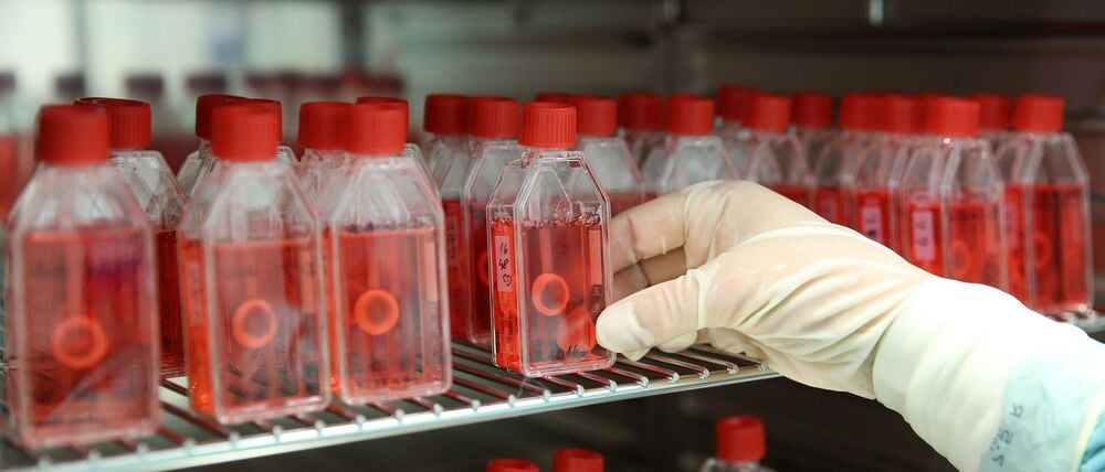 In einer Gewebebank zeigt eine Mitarbeiterin den Brutschrank mit präparierter menschlicher Hornhaut.