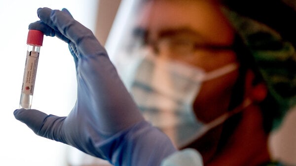 Ein Arzt hält in der Corona-Teststelle einen Abstrich für einen Coronavirus-Test.