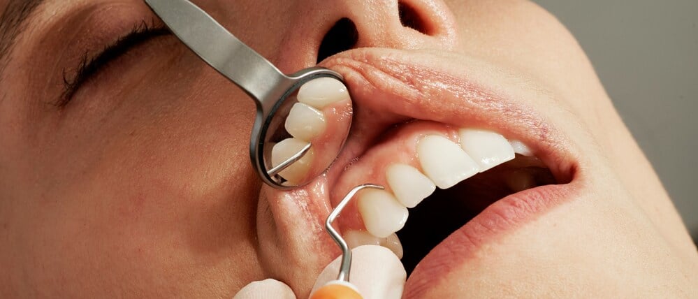 Ein Zahnarzt schaut sich die Zähne seiner Patienten an.