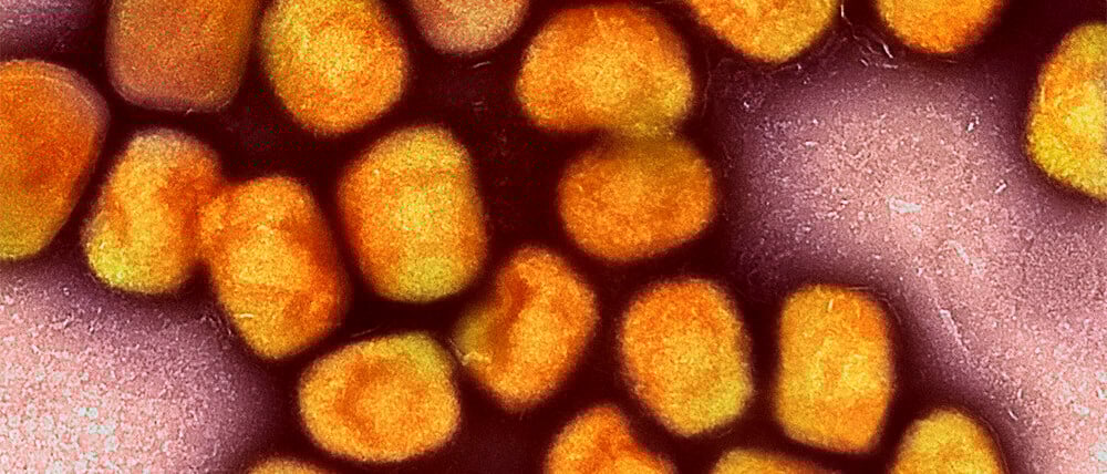 Eine eingefärbte Aufnahme von Mpox-Viren unter dem Elektronenmikroskop.