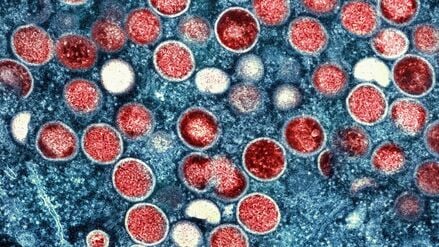 Eine eingefärbte Mikroskopaufnahme von Mpox-Partikeln (rot) in einer infizierten Zelle (blau), die im Labor kultiviert wurde.