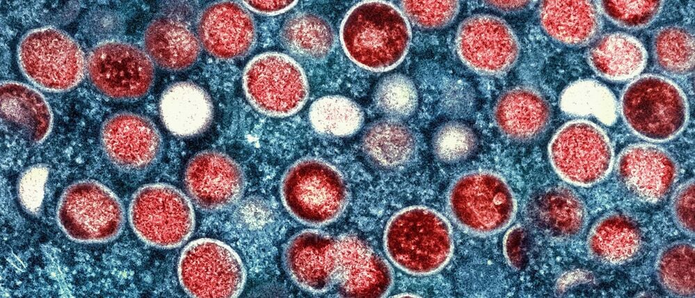 Eine eingefärbte Mikroskopaufnahme von Mpox-Partikeln (rot) in einer infizierten Zelle (blau), die im Labor kultiviert wurde.