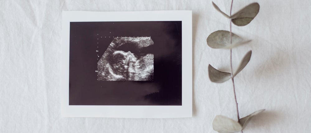 Wie ich mich nach meiner Fehlgeburt plötzlich unglaublich stark fühlte (Symbolbild).