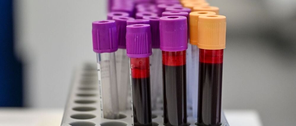 Eine Blutspende kann bis zu drei Menschen helfe (Symbolbild).