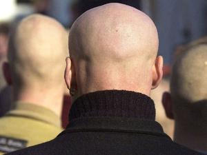 070723skinheads