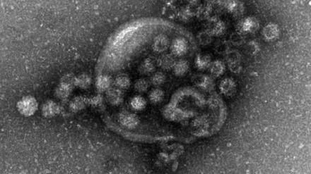 Novovirus