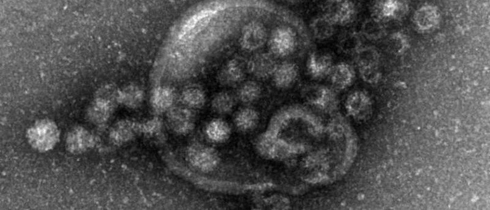 Novovirus
