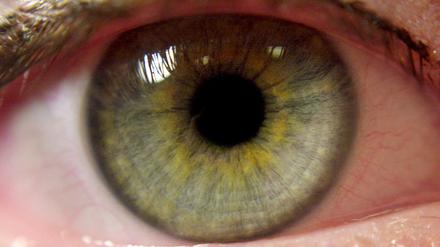 Auge