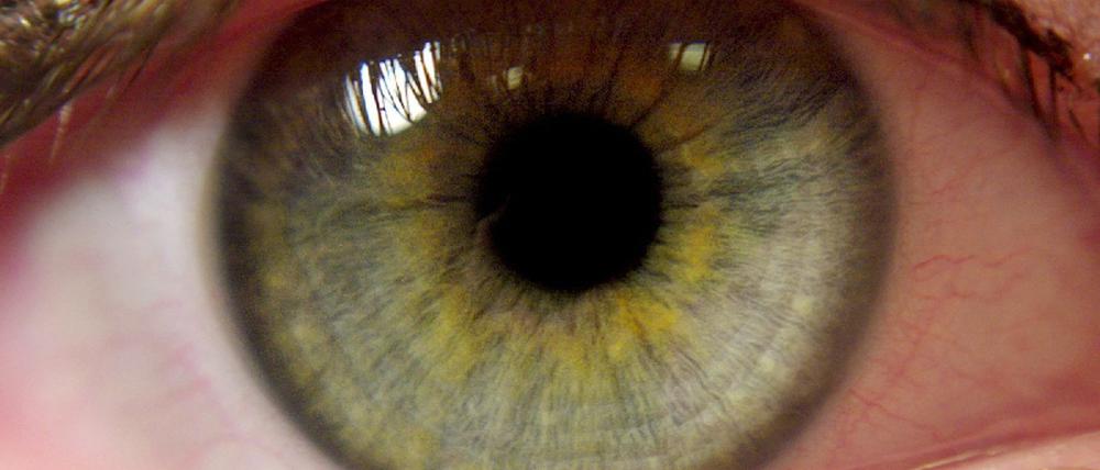 Auge