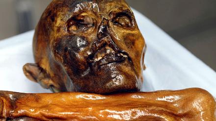 Ötzi