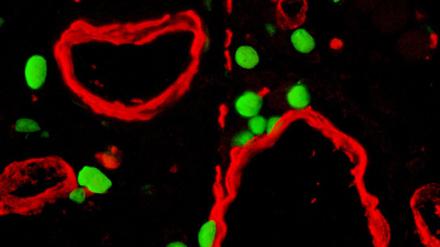 Chemie-Nobelpreis - GFP-positive Zellen
