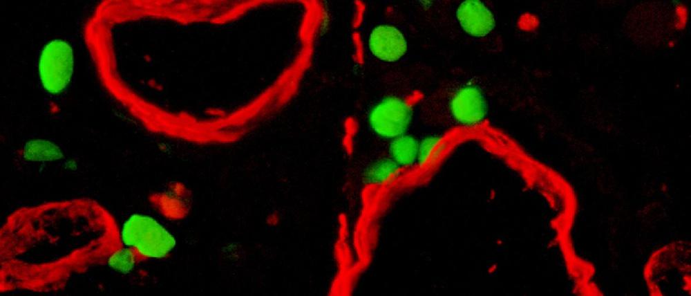 Chemie-Nobelpreis - GFP-positive Zellen