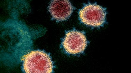 Das Coronavirus stammt aus einem Säugetier, doch von welcher Spezies es  vor etwa einem Jahr auf den Menschen übersprang, ist offen.