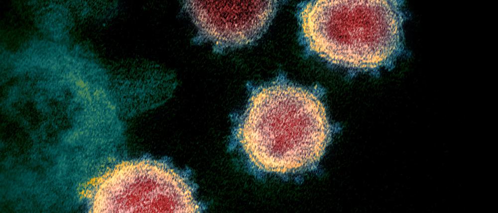 Das Coronavirus stammt aus einem Säugetier, doch von welcher Spezies es vor etwa einem Jahr auf den Menschen übersprang, ist offen.