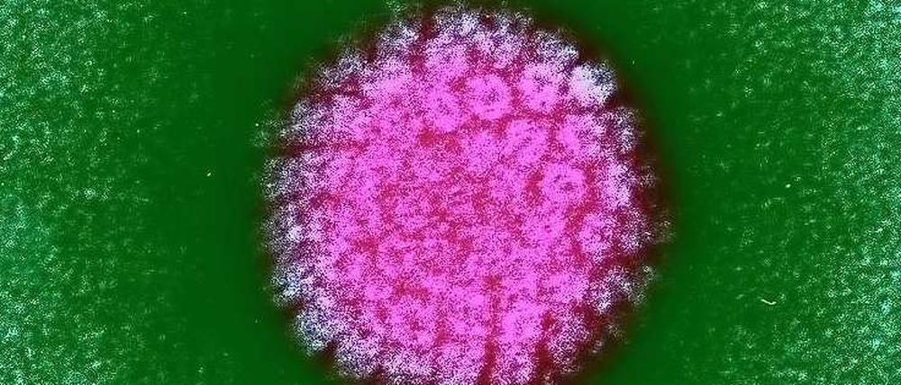 Ein Papillomavirus unter dem Elektronenmikroskop.