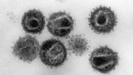 Elektronenmikroskopische Aufnahme mehrerer HIV.