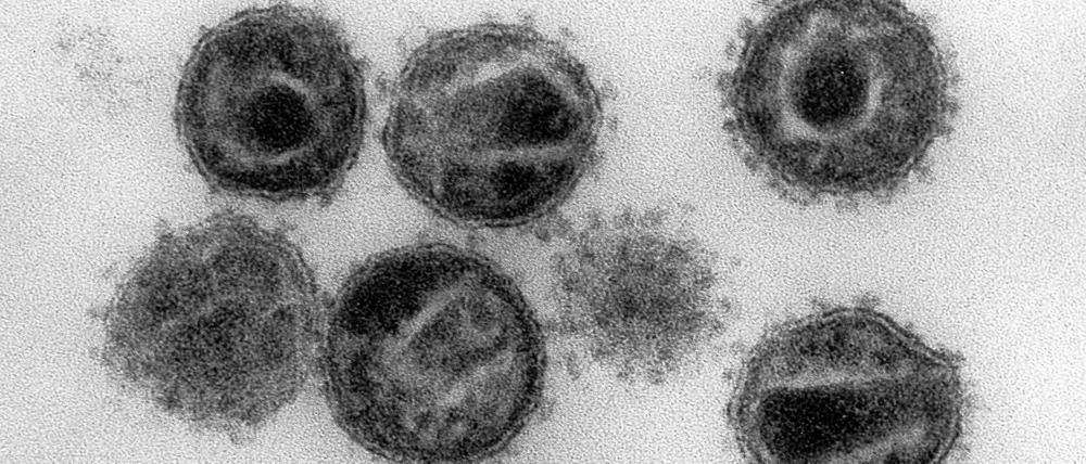 Elektronenmikroskopische Aufnahme mehrerer HIV.