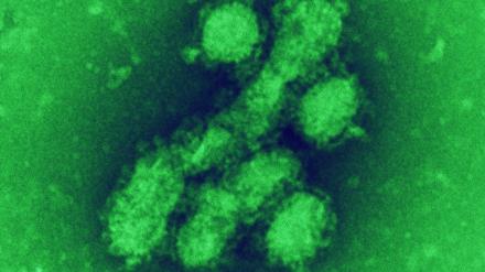 Schweinegrippevirus