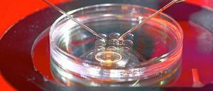 Nadelprobe. Nicht alle der künstlich befruchteten Eizellen entwickeln sich zu gesunden Embryonen.