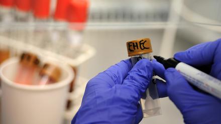 Die Zahl von blutigen Durchfallerkrankungen, die vom EHEC-Erreger ausgelöst werden, nimmt weiter zu.