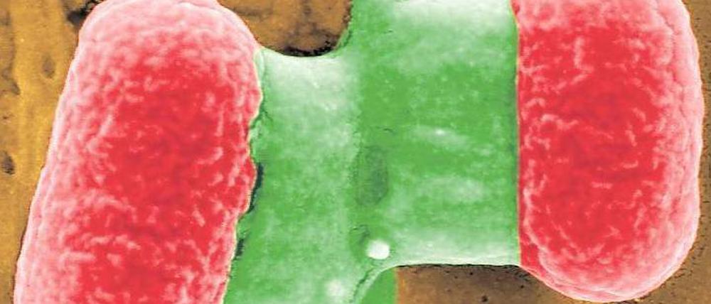 Lebensgefährlich. Das EHEC-Bakterium. Bisher gab es gegen die Erkrankung kein Mittel. Jetzt gibt es Hoffnung.
