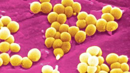 Kugelförmige Staphylokokken leben häufig auf der Haut. Meist sind sie harmlos – und manchmal resistent gegen Antibiotika.