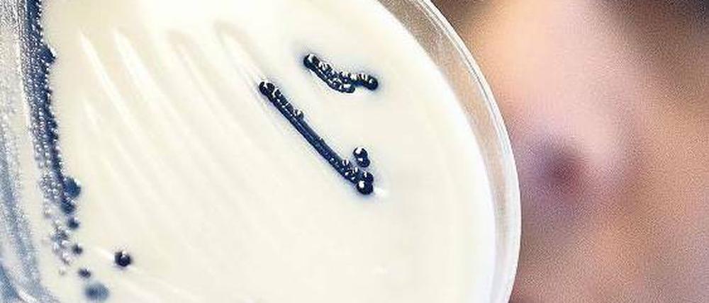 Gefährlicher Keim. 3842 Menschen erkrankten in diesem Sommer in Deutschland an einer Ehec-Infektion, 53 starben an den Folgen, heißt es im Abschlussbericht des RKI. Foto: dapd