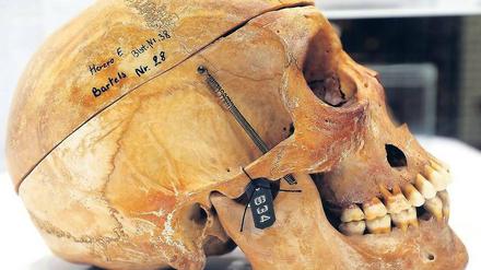 Vor der Übergabe. Der Schädel eines Herero aus der Charité-Sammlung. 20 Stück wurden nun zurückgegeben - mehr als 100 Jahre nach ihrem Tod.