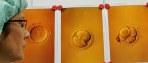 Forscher haben herausgefunden: Frauen bilden neue Eizellen.