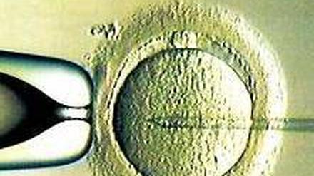 Künstlich befruchtet. Forscher testen neue Verfahren.